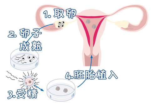 有偿试管代妈机构